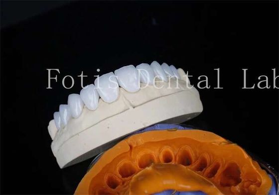 購入 ポルセラン 歯科 検査室 フリーナー 粘着 セメント 長期 回復 online manufacture