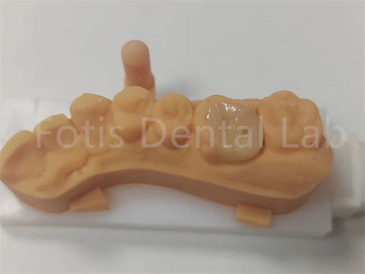 購入 歯 の 修復 陶器 の 挿し木 と 敷き木 の 耐久性 online manufacture