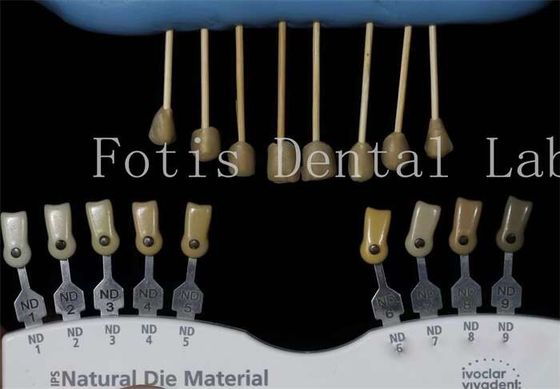 耐久性 0.3-0.5mm 厚さの歯科研究室のファニヤ 偽の歯のファニヤ