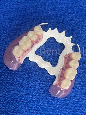 汚れに耐える 抜ける歯の部分 安定 欠損した歯を入れ替える