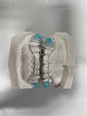 プロの快適なフィット保持器 拡張器 正歯矯正装置